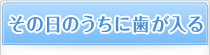 その日のうちに歯が入る